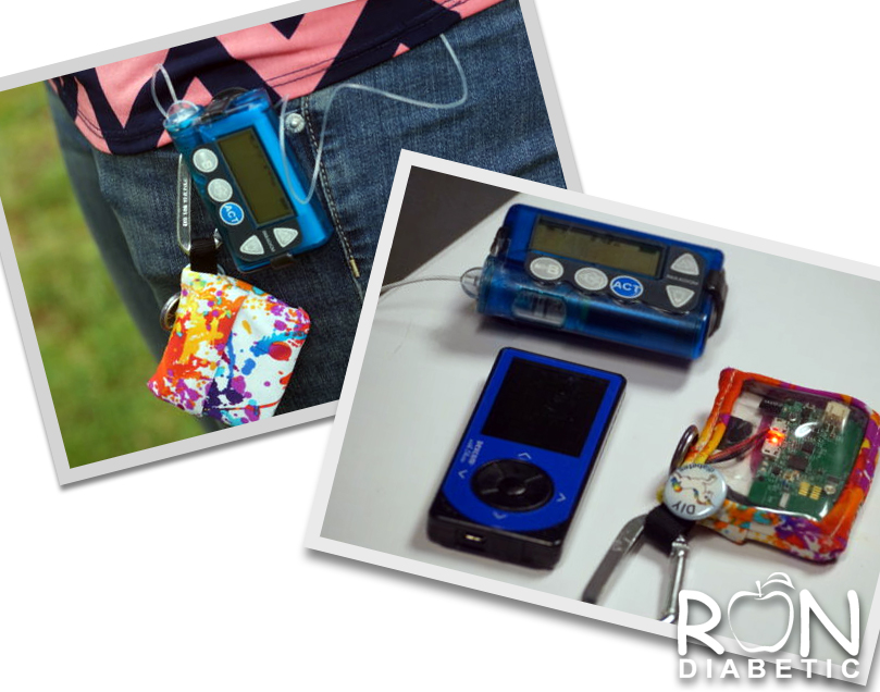 Устройство "OpenAPS" (Искусственная поджелудочная железа) имеет успех - сотни людей уже используют его, в том числе и Дана Люис, и привлекают внимание молодых изобретателей.