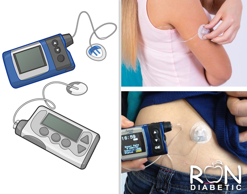 Традиционная помпа с использованием длинной, гибкой пластиковой трубки